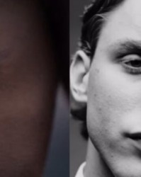 Kaiyun sport-罗体：博维首度公开心脏手术疤痕，为香水品牌拍摄广告